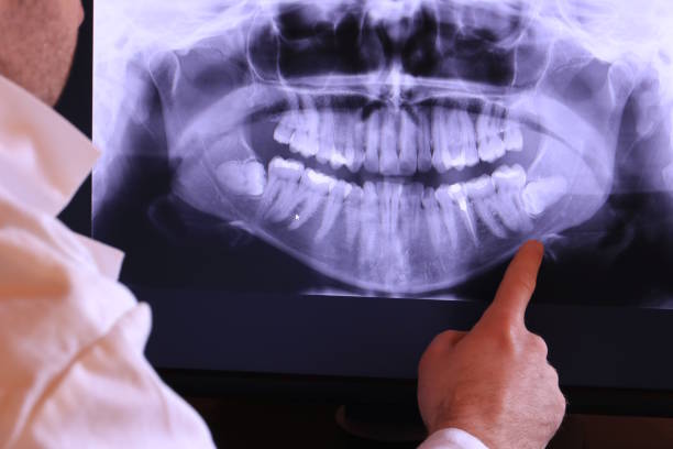 Best Dental Abscess Treatment in Satsuma, AL
